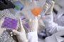 Brazilian psychiatrist Frederico Garcia (out of frame), associate professor in the Department of Mental Health of the Faculty of Medicine and researcher responsible in the development of Calixcoca, a vaccine for cocaine and crack addiction, holds a microplate with samples, at the Federal University of Minas Gerais (UFMG), in Belo Horizonte, state of Minas Gerais, on June 7, 2023. Inhibiting the addictive effects of cocaine or crack to prolong the abstinence of users who are struggling to quit: this is the objective of "Calixcoca", a promising therapeutic vaccine developed by Brazilian scientists. This project won a prize of 500,000 euros last week from the pharmaceutical company Eurofarma intended to finance innovative solutions with "high impact" in the health sector. (Photo by Douglas Magno / AFP)Editoria: HTHLocal: Belo HorizonteIndexador: DOUGLAS MAGNOSecao: health treatmentFonte: AFPFotógrafo: STR<!-- NICAID(15579913) -->