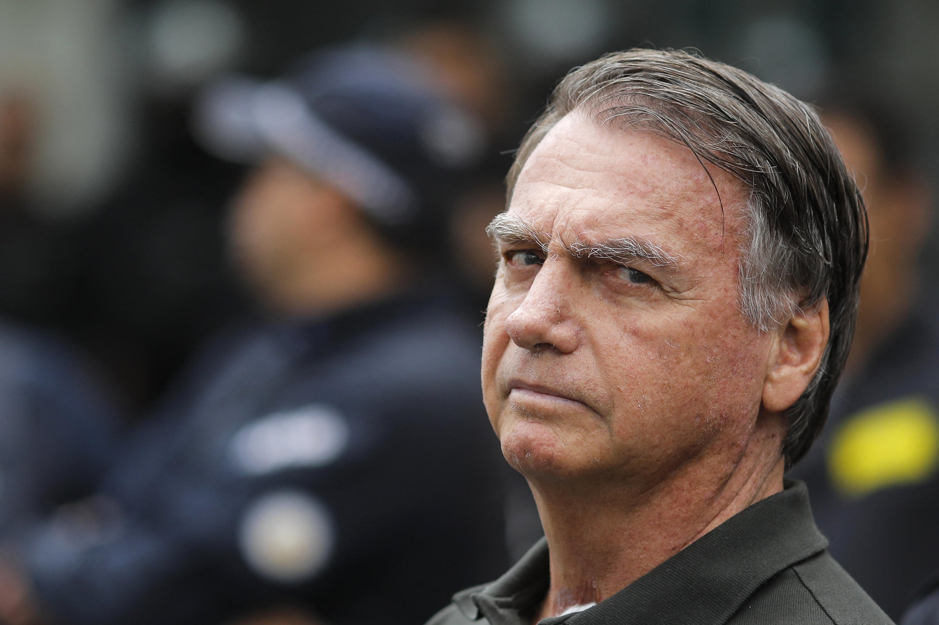 Cirurgia termina com sucesso, mas Bolsonaro ainda n&atilde;o tem previs&atilde;o de alta