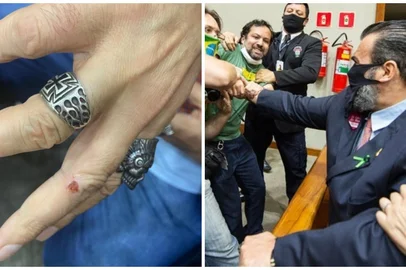 Dedo mordido protesto Câmara de Vereadores