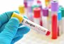 RS é o terceiro Estado que mais realizou testes rápidos de dengue no início de março, diz levantamento