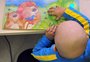 Doenças que compõem o câncer infantojuvenil são as que mais matam entre 1 e 19 anos