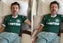 Medicamento experimental para Lito Souza chega ao Brasil