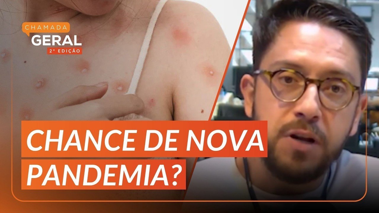 V&Iacute;RUS MPOX EM PORTO ALEGRE: cidade registra primeiro caso da doen&ccedil;a em 2026