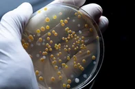 Close up of colourful bacterial colonies in Petri dish. Hand wearing white sterile glove holding lab glass. Medical laboratory, medical glassware concept.<!-- NICAID(16281403) -->
