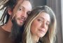 Marido de Letícia Spiller relata ataques em relação aos seus dentes e propõe reflexão: "Aparência tem prioridade sobre conteúdo?"