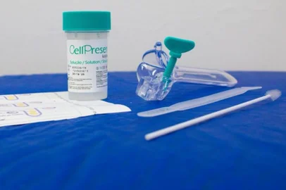 Um novo exame gratuito para detecção de papilomavírus humano (HPV) começou a ser implementado pelo Ministério da Saúde no Sistema Único de Saúde (SUS) em agosto. Com tecnologia 100% nacional, o teste de biologia molecular DNA-HPV detecta 14 tipos de HPV, identificando a presença do vírus no organismo antes da ocorrência de lesões ou câncer em estágios iniciais.O HPV é a principal causa do câncer de colo do útero, terceiro tipo mais incidente em mulheres, de acordo com o Ministério da Saúde. O método moderno faz parte do novo rastreamento desse tipo de câncer na rede pública e aumenta as chances de cura. A iniciativa integra o programa Agora Tem Especialistas. O exame é produzido pelo Instituto de Biologia Molecular do Paraná, ligado à Fiocruz.<!-- NICAID(16114517) -->