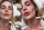 Saiba qual é o procedimento escolhido por Yasmin Brunet para parecer mais jovem