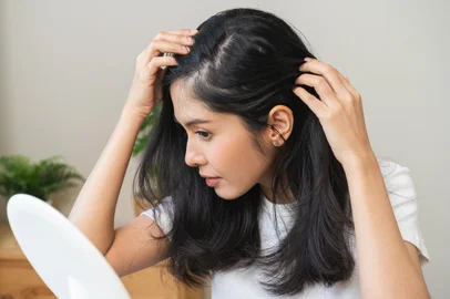 Damaged hair symptom, problem hair fall asian young woman, girl worry about balding, looking at scalp in mirror, hand in break into front hair loss, thin problem. Health care treatment for beauty.Fonte: 634401910<!-- NICAID(15802599) -->
