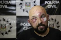 PORTO ALEGRE, RS, BRASIL, 26-11-2015 :  Bráulio Escobar, motorista Uber, em coletiva de imprensa. Bráulio foi espancado por taxistas em Porto Alegre. (Foto: André Ávila/Agência RBS, Notícias)<!-- NICAID(11850253) -->