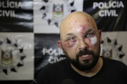 PORTO ALEGRE, RS, BRASIL, 26-11-2015 :  Bráulio Escobar, motorista Uber, em coletiva de imprensa. Bráulio foi espancado por taxistas em Porto Alegre. (Foto: André Ávila/Agência RBS, Notícias)<!-- NICAID(11850253) -->