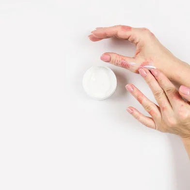 A woman applies cream to her hands to treat dermatitis. Skin diseases. Close-up.A woman applies cream to her hands to treat dermatitis. Skin diseases. Close-up. Flat lay.Fonte: 300892371<!-- NICAID(14916610) -->