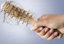 Conheça a alopecia androgenética, tipo de "calvície feminina"