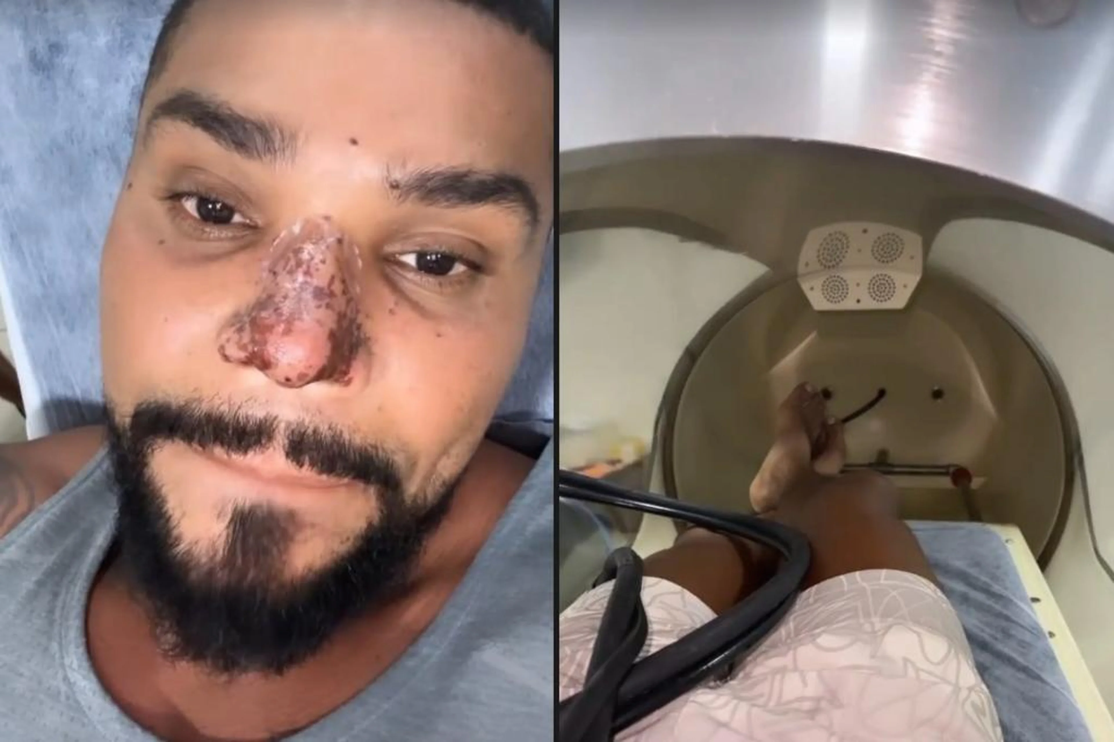 Reprodução/Instagram @naldobenny