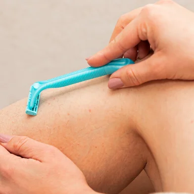 Adobe.Stock - AcneClose up picture of folliculitis on human skin, woman fingers popping it outIndexador: OCSKAY MARKFonte: 333389936<!-- NICAID(15970733) -->