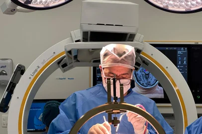 Avanço tecnológico aprimora cirurgia para tratar de doença de Parkinson. Na foto, Alexandre Reis, especialista em Distúrbios do Movimento e neurocirurgião funcional do Hospital Moinhos de Vento - Foto: Hospital Moinhos de Vento/Divulgação<!-- NICAID(15948304) -->