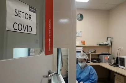 O aumento do número de casos de coronavírus leva o sistema de saúde de Caxias do Sul à beira do colapso. Colapsar significa que os hospitais perderam a margem de manobra porque todos os lugares estão sobrecarregados, uma vez que toda a infraestrutura hospitalar está sendo demandada ao mesmo tempo. O contágio faz com que um número expressivo de pessoas precisem de atendimento ao mesmo tempo, esgota os leitos de enfermaria e de UTI, tanto na rede pública, quanto privada, e acaba impactando todos os demais procedimentos. <!-- NICAID(14728618) -->