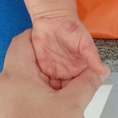 A prefeitura de Imbé, no Litoral Norte, afastou duas professoras concursadas e exonerou outra profissional após a denúncia de maus-tratos a um menino de 1 ano e 8 meses em uma escola do município. A situação está sendo investigada pela Polícia Civil. <!-- NICAID(16260672) -->