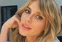 Carolina Dieckmann explica por que decidiu retirar próteses de silicone: "Não devia nem ter colocado "