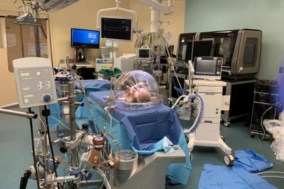 Médico gaúcho lidera estudo que altera tipo sanguíneo de pulmão para simulação de transplante<!-- NICAID(15026600) -->