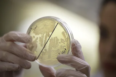 PORTO ALEGRE, RS, BRASIL, 26-08-2025: Meio de cultivo de baterias no Laboratorio de Pesquisa em Resistencia Bacteriana (Labresis), coordenado pelo professor e farmaceutico Afonso Barth, no Hospital de Clinicas de Porto Alegre. Conforme estudo da Sociedade Brasileira de Infectologia, em parceria com o Instituto Qualisa de Gestao, 87% dos hospitais fazem uso de antibioticos por tentativa e erro, o que pode favorecer a resistencia de bacterias diante de alguns medicamentos. Foto: Mateus Bruxel/Agencia RBSIndexador: MATEUS BRUXEL<!-- NICAID(16111253) -->