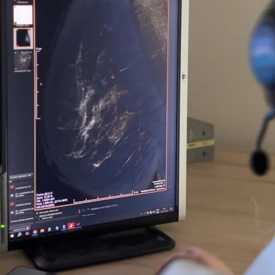 “Hoje o tratamento é personalizado”, diz mastologista sobre diagnóstico precoce do câncer de mama<!-- NICAID(16143366) -->