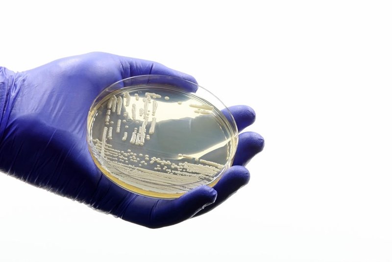 Gloved medical or scientific hand, with a microbiological culture of Candida auris yeast, an antimicrobial-resistant pathogen.Fonte: 603223980<!-- NICAID(15441922) -->