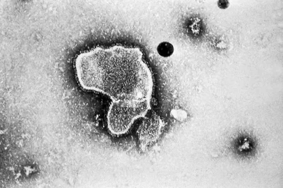 A China enfrenta um aumento expressivo de casos de metapneumovírus humano (HMPV). A doença têm afetado especialmente entre crianças com menos de 14 anos. <!-- NICAID(15948098) -->