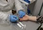 Hepatites virais matam 3,5 mil pessoas por dia no mundo, alerta OMS
