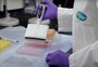 Entenda como funciona a tecnologia de RNA mensageiro e por que ela é considerada o futuro das vacinas