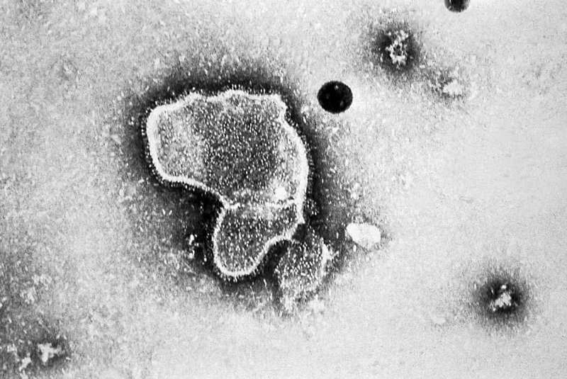 Imagem de microscópio do vírus sincicial respiratório (VSR)