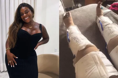 A cantora e influenciadora Jojo Todynho chamou atenção nas redes sociais ao contar que realizou uma cirurgia para melhorar a definição das pernas<!-- NICAID(16340827) -->