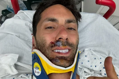 Apresentador do "Catfish" é atropelado e quebra o pescoço: "Sorte de estar vivo"<!-- NICAID(15838835) -->