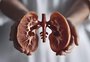 "É uma catástrofe", alerta médico do Hospital de Clínicas sobre cenário da doença renal crônica