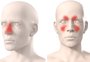 Rinite ou sinusite? Saiba as diferenças entre as doenças respiratórias