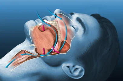 Ronco. Foto: Axel Kock / stock.adobe.comFonte: 375205664<!-- NICAID(15867468) -->