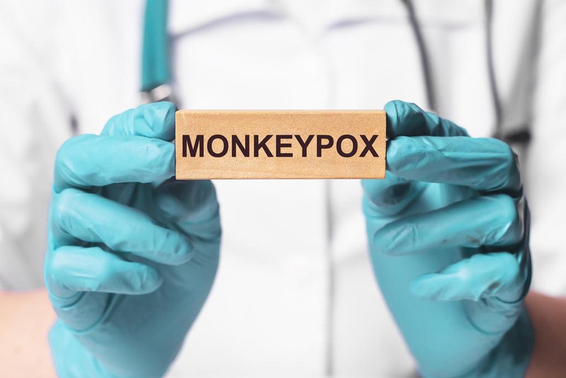 Monkeypox virus concept. Monkey smallpox typevaríola dos macacos. Foto: valiantsin  / stock.adobe.comIndexador: VALENTIN SUPRUNOVICHFonte: 506585514<!-- NICAID(15185053) -->