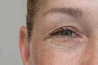 Natural eyes with excess eyelid skin, close-upClose-up of middle-aged woman showing upper eyelid foldFonte: 1688798941<!-- NICAID(16238741) -->