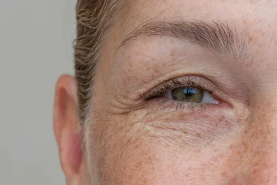 Natural eyes with excess eyelid skin, close-upClose-up of middle-aged woman showing upper eyelid foldFonte: 1688798941<!-- NICAID(16238741) -->