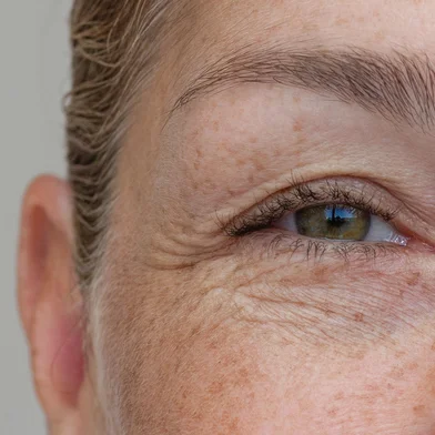 Natural eyes with excess eyelid skin, close-upClose-up of middle-aged woman showing upper eyelid foldFonte: 1688798941<!-- NICAID(16238741) -->