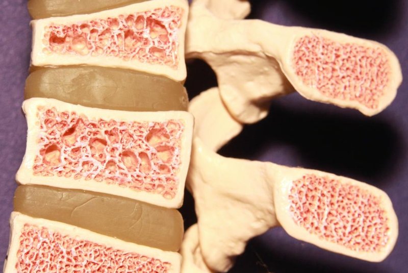 Model of spine showing porous bone marrow in case of osteoporosisFonte: 259754779<!-- NICAID(14917936) -->