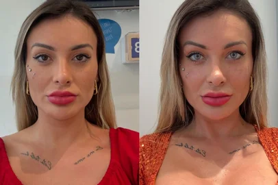 Influencers viajam para a França para realizar cirurgia de mudança da cor do olho<!-- NICAID(16071488) -->