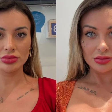 Influencers viajam para a França para realizar cirurgia de mudança da cor do olho<!-- NICAID(16071488) -->