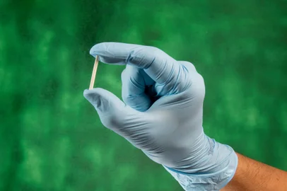 hand in rubber gloves holding a hormonal implant.Especialistas alertam para riscos à saúde e falta de estudos sobre o uso de chips  - Foto: Celso Pupo/stock.adobe.comFonte: 467437573<!-- NICAID(15939643) -->