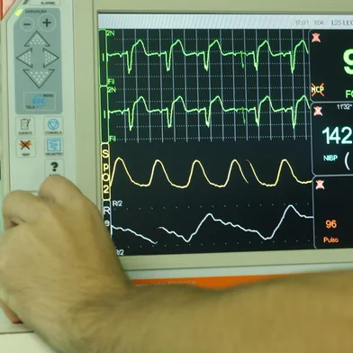 equipamento da cti<!-- NICAID(1659868) -->