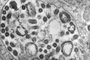 Imagem de uma amostra de tecido revela a presença de numerosas partículas do vírus de Marburg.Foto: Dr. Fred Murphy/ Sylvia Whitfield/ CDC<!-- NICAID(14859631) -->