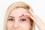 woman shows drooping eyelid for plastic surgeryPalpebras, cirurgia plástica. Foto: Angelov   /stock.adobe.comIndexador: sinenkiyFonte: 423986935<!-- NICAID(14880567) -->