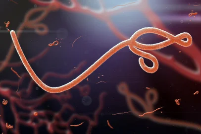 Microscopic view of the ebola virusFonte: 68744456<!-- NICAID(15210944) -->