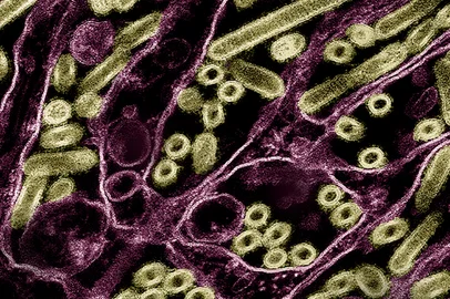 Partículas do vírus da influenza aviária A H5N1 observadas em um rim canino pelo Instituto Nacional de Alergia e Doenças Infecciosas dos EUA, em maio de 2024; caso de infecção em humano é investigado no Canadá <!-- NICAID(15911487) -->