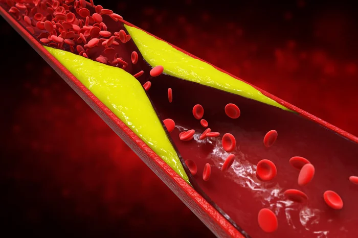 phonlamaiphoto / stock.adobe.com