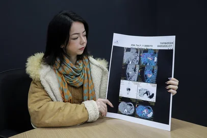 CAXIAS DO SUL, RS, BRASIL. 23.06.2025. A estudante de Administração Bruna Maria Gettert, 24 anos, levou quase quatro anos para ter o diagnóstico correto de tumor neuroendócrino bem diferenciado de grau 2. Ela compartilha informações sobre a saga até ter um diagnóstico correto e o tratamento nas redes sociais.(Ulisses Castro / Agência RBS).Indexador: Bruno Todeschini<!-- NICAID(16065327) -->